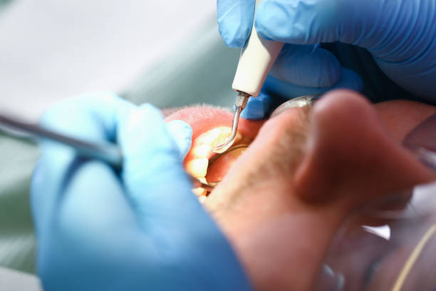 Best Broken or Chipped Tooth Repair in Morton, PA